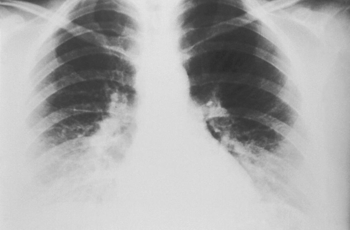 Lung Purification Program: Reset Your Breathing, Reclaim Your Energy